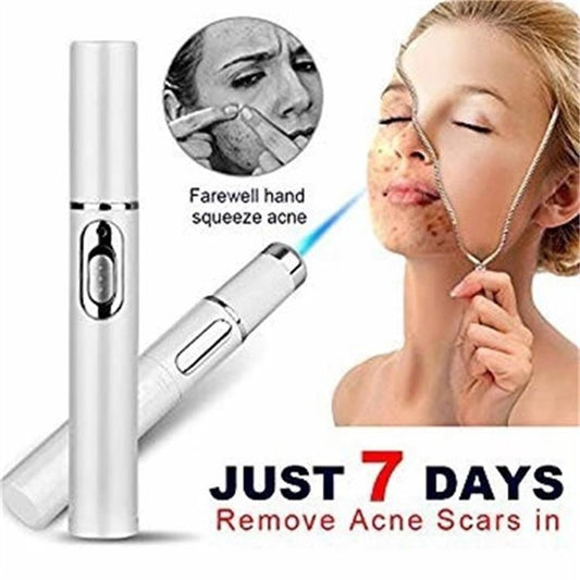 Acne Removal Laser Pen – Blue Light Therapy for Clear & Smooth Skin