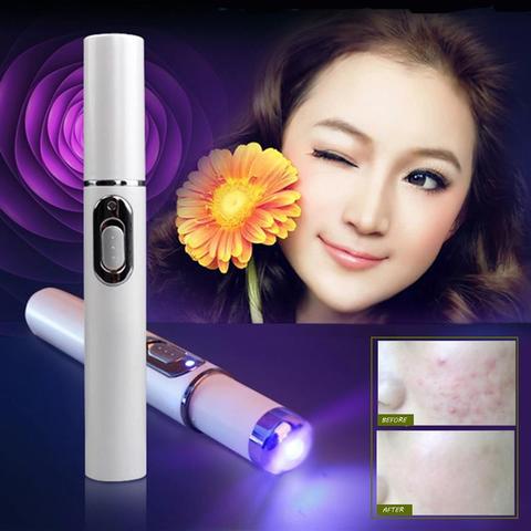 Acne Removal Laser Pen – Blue Light Therapy for Clear & Smooth Skin