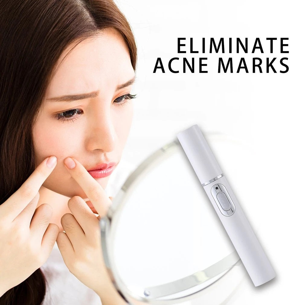 Acne Removal Laser Pen – Blue Light Therapy for Clear & Smooth Skin